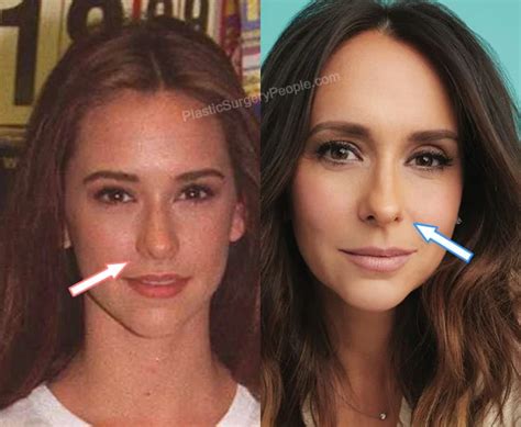 has jennifer love hewitt had plastic surgery|Jennifer Love Hewitt Transformation, Plastic Surgery Speculation